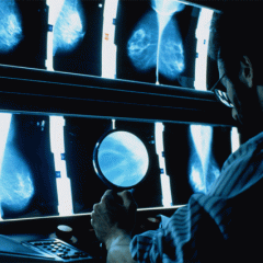 What to Expect During a Mammogram