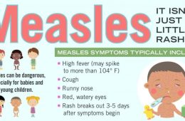 Measles Continues to Spread Especially in Unvaccinated Children